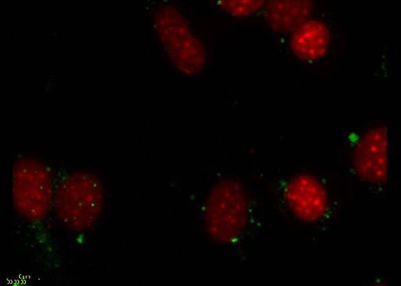 PML Movie 5: SK-N-SH transfected with PML. A field of SK-N-SH human neuroblastoma cells transfected with PML-DsRed (green) and counterstained with Hoechst to visualize the chromatin (red).