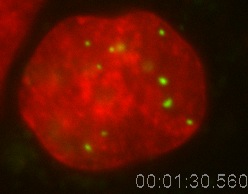 PML Movie 9:SK-N-SH transfected with PML. An SK-N-SH human neuroblastoma cells transfected with PML-DsRed (green) and counterstained with Hoechst to visualize the chromatin (red).