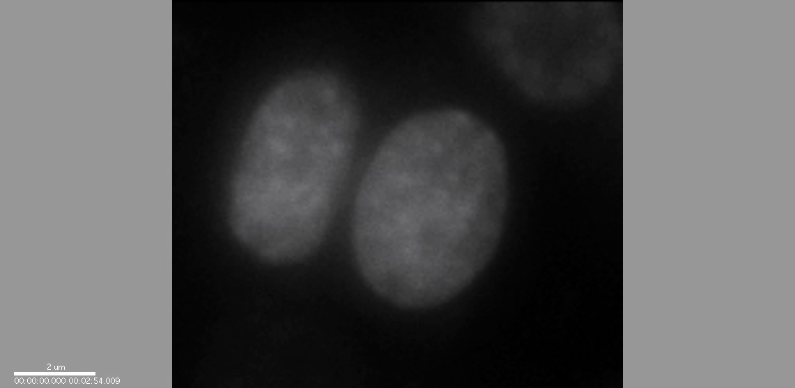 Mitosis Movie 10: MCF-7 cells expressing DsRed-Histone H1
