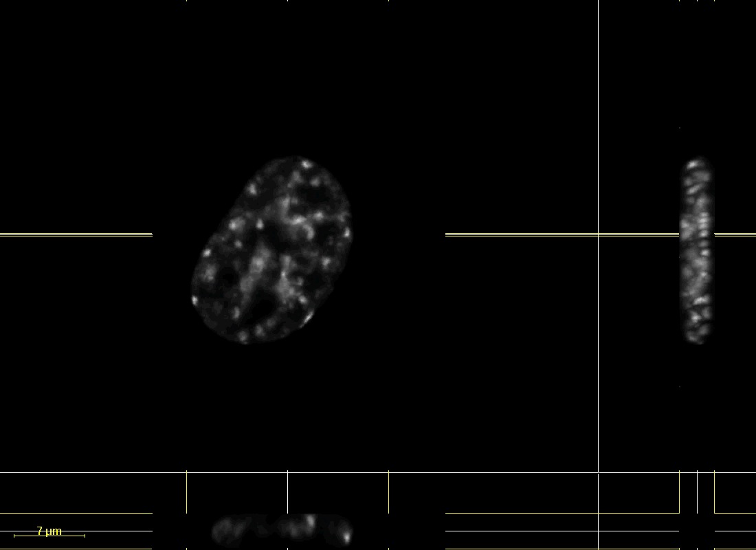 Chromatin Movie 1: An SK-N-SH cell transfected with DsRed-Histone H1. XY, XZ, and YZ images of a dataset deconvolved using Huygens (Scientific Volume Imaging) deconvolution software. 